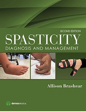 portada Spasticity: Diagnosis and Management 
