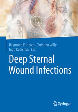 portada Deep Sternal Wound Infections (en Inglés)