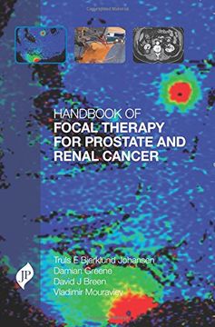 portada Handbook of Focal Therapy for Prostate and Renal Cancer
