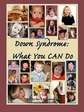 portada down syndrome: what you can do (en Inglés)
