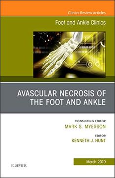 portada Avascular Necrosis of the Foot and Ankle, an Issue of Foot and Ankle Clinics of North America, 1e: Volume 24-1 (The Clinics: Orthopedics) (en Inglés)