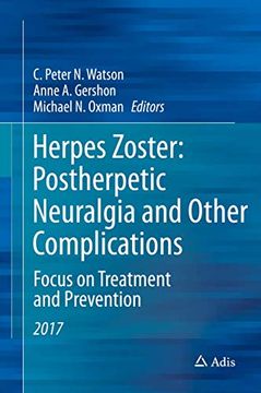 portada Herpes Zoster: Postherpetic Neuralgia and Other Complications: Focus on Treatment and Prevention (in English)