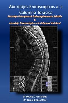 portada Abordajes Endoscopicos a la Columna Toracica: Abordaje retropleural endoscopicamente asistido & Abordaje toracoscopico a la columna vertebral