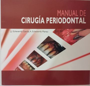 portada Manual de Cirugia periodontal