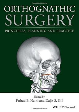 portada Orthognathic Surgery: Principles, Planning and Practice