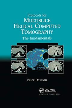portada Protocols for Multislice Helical Computed Tomography: The Fundamentals (en Inglés)