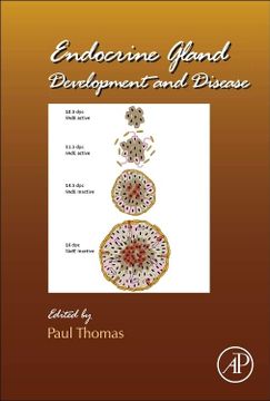 portada Endocrine Gland Development and Disease (Volume 106) (Current Topics in Developmental Biology, Volume 106) (in English)