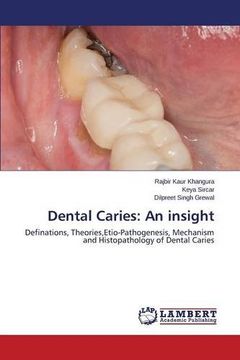 portada Dental Caries: An insight