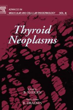 portada thyroid neoplasms (en Inglés)