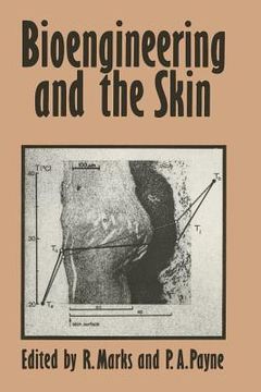 portada Bioengineering and the Skin: Based on the Proceedings of the European Society for Dermatological Research Symposium, Held at the Welsh National Sch (en Inglés)