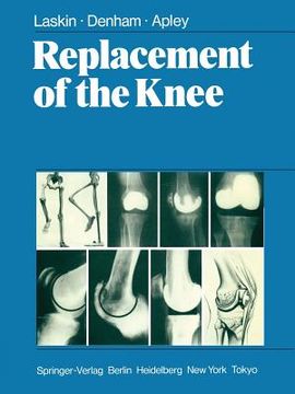 portada Replacement of the Knee (en Inglés)