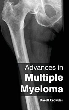 portada Advances in Multiple Myeloma (en Inglés)