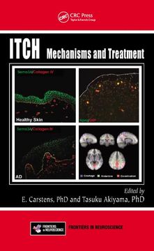 portada Itch: Mechanisms and Treatment (en Inglés)