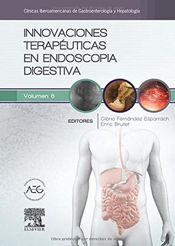 portada Innovaciones terapéuticas en endoscopia digestiva (in Spanish)