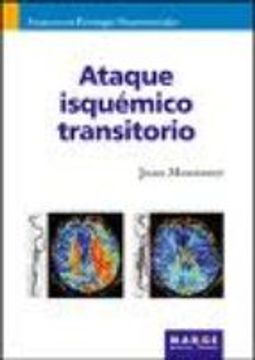 ataque isquémico transitorio