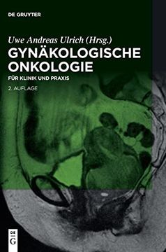 portada Gynäkologische Onkologie: Für Klinik und Praxis (en Alemán)