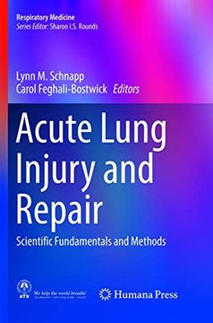 portada Acute Lung Injury and Repair: Scientific Fundamentals and Methods (en Inglés)
