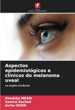 portada Aspectos Epidemiológicos e Clínicos do Melanoma Uveal: Na Argélia Ocidental