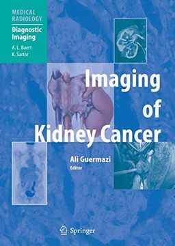 portada Imaging of Kidney Cancer (en Inglés)