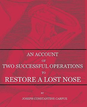 portada an account of two successful operations for restoring a lost nose