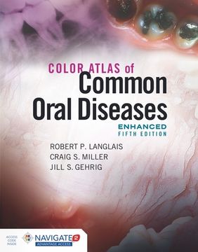 portada Color Atlas of Common Oral Diseases, Enhanced Edition (en Inglés)