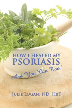 portada How i Healed my Psoriasis: And you can Too! (en Inglés)