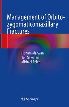 portada Management of Orbito-Zygomaticomaxillary Fractures