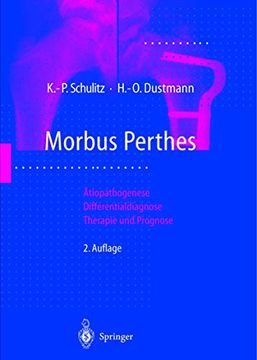 portada Morbus Perthes: Ätiopathogenese, Differentialdiagnose, Therapie und Prognose (en Alemán)