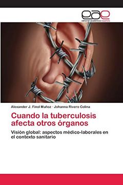 portada Cuando la Tuberculosis Afecta Otros Órganos