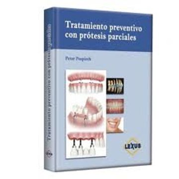 portada TRATAMIENTO PREVENTIVO CON PROTESIS PARCIALES 1 TOMO