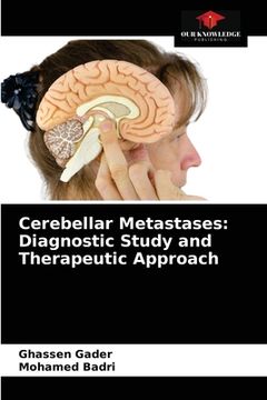 portada Cerebellar Metastases: Diagnostic Study and Therapeutic Approach (en Inglés)