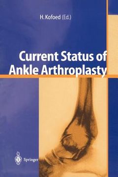 portada current status of ankle arthroplasty (en Inglés)