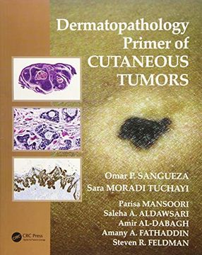 portada Dermatopathology Primer of Cutaneous Tumors (in English)
