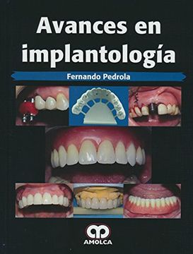 portada Avances en Implantología (in Spanish)