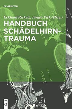 portada Handbuch Schädel-Hirn-Trauma (en Alemán)