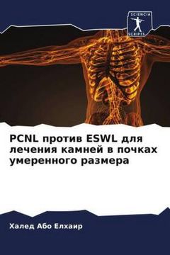 portada Pcnl против Eswl для лечения к (en Ruso)