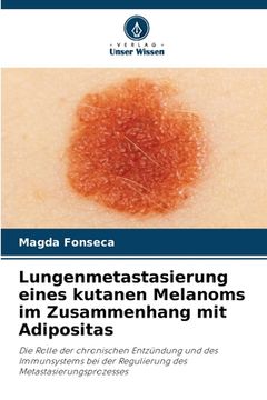 portada Lungenmetastasierung eines kutanen Melanoms im Zusammenhang mit Adipositas