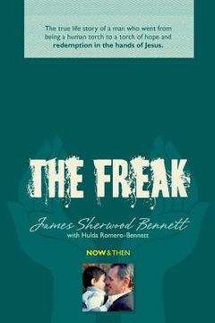 portada The Freak: The true life story of a man who went from being a human torch to a torch of hope and redemption in the hands of Jesus (en Inglés)