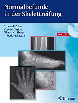portada Normalbefunde in der Skelettreifung (en Alemán)