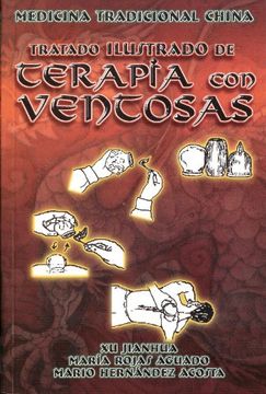 portada Medicina Tradicional China. Tratado Ilustrado de Terapia con Ventosas by xu Jianhua (2008-06-05) (in Spanish)