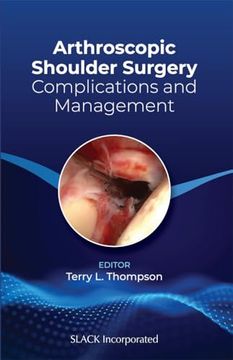 portada Arthroscopic Shoulder Surgery: Complications and Management (en Inglés)