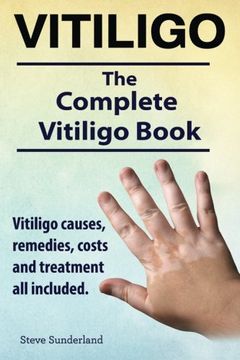 portada Vitiligo. Vitiligo Causes, Remedies, Costs and Treatment all Included. The Complete Vitiligo Book.