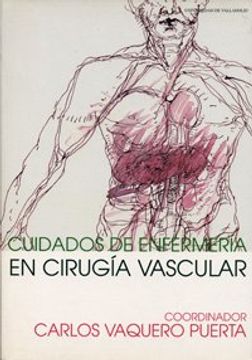 Cuidados de Enfermería en Cirugía Vascular