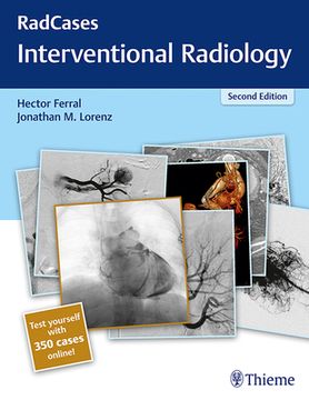 Radcases Q&A Interventional Radiology (en Inglés)