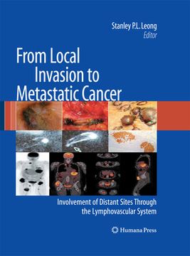 portada From Local Invasion to Metastatic Cancer: Involvement of Distant Sites Through the Lymphovascular System (en Inglés)