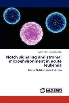 portada notch signaling and stromal microenvironment in acute leukemia (en Inglés)