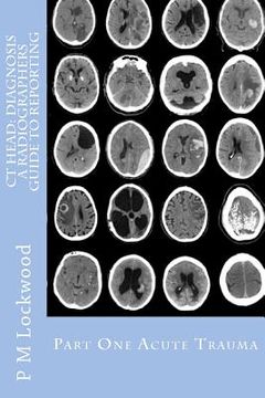 portada ct head: diagnosis a radiographers guide to reporting part 1 acute trauma (en Inglés)