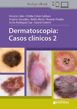 portada Dermatoscopia: Casos Clínicos 2