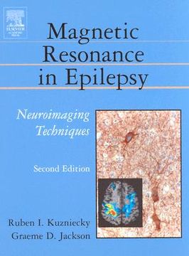 portada magnetic resonance in epilepsy: neuroimaging techniques