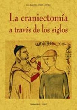 portada La Craniectomía a Través de los Siglos (in Spanish)